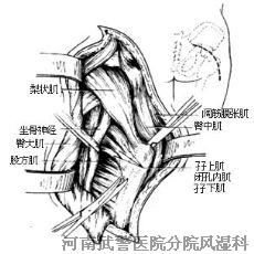 类风湿需要做哪些检查?